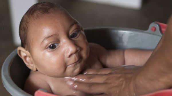 Ζίκα: Ελπίδες για ανάπτυξη εμβολίου μέσα σε έναν χρόνο