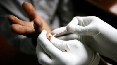 Πρόσβαση σε δωρεάν και ανώνυμες εξετάσεις για HIV
