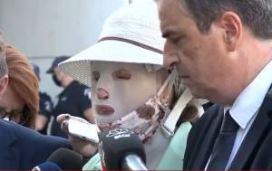 Επίθεση με βιτριόλι: Το ξέσπασμα της Ιωάννας για την κατηγορούμενη