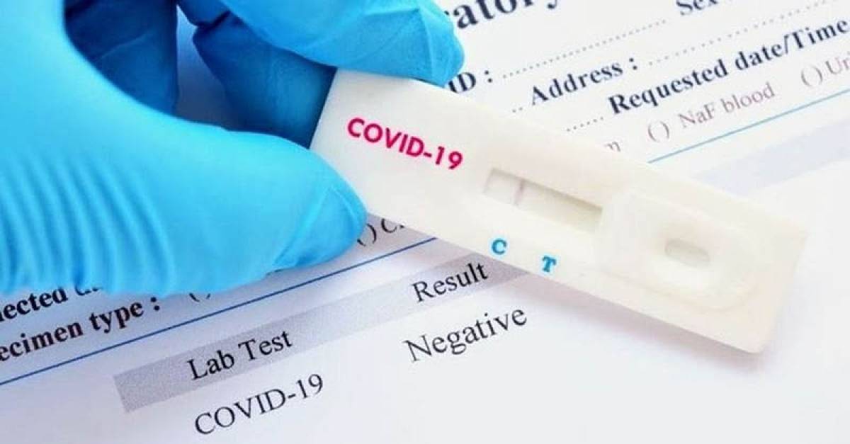 ΕΟΔΥ: Αποτελέσματα Rapid tests-Πού διενεργούνται δωρεάν έλεγχοι σήμερα