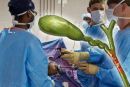 Χολοκυστεκτομή: Επέμβαση ρουτίνας αλλά με βαριές επιπλοκές αν είναι άπειρος ο χειρουργός