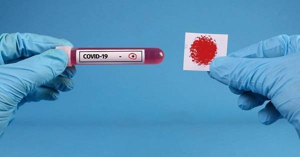 Λουκίδης: Δύο self test ισοδυναμούν με ένα μοριακό