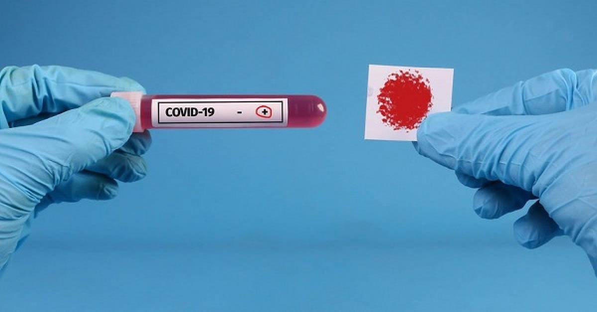 Λουκίδης: Δύο self test ισοδυναμούν με ένα μοριακό