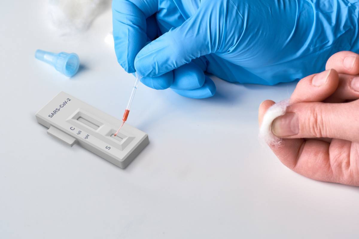 Rapid-test: Διευκρινίσεις για την υποβολή της υπεύθυνης δήλωσης στο ΕΡΓΑΝΗ