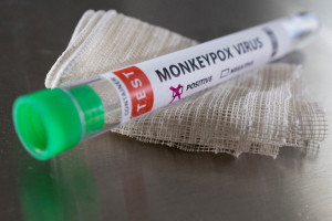 Πονοκέφαλος οι μεταλλάξεις της Ευλογιάς των Πιθήκων