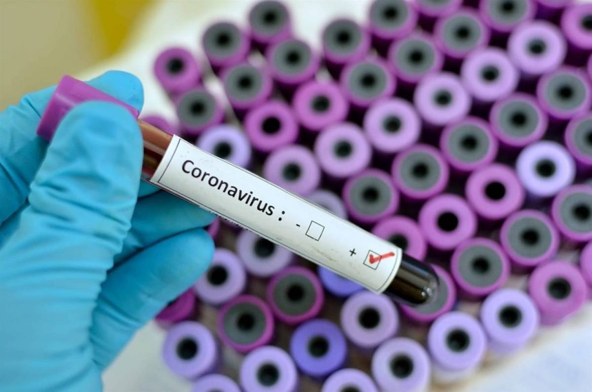 Covid-19: Η καμπύλη της Ελλάδας-Σύγκριση με Ολλανδία, Βέλγιο και Πορτογαλία