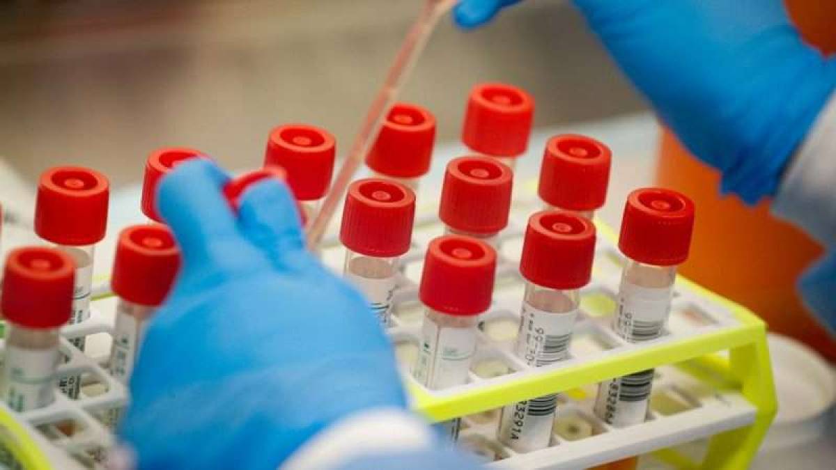 Πότε χρειάζεται τεστ αντισωμάτων μετά τον εμβολιασμό κατά της Covid-19