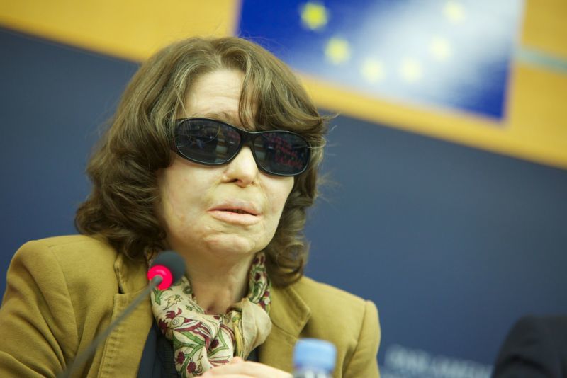 Κούνεβα: Θα σεβαστεί η Κομισιόν τη βούληση των κοινωνικών εταίρων για τα εργασιακά;
