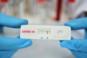 Δωρεάν rapid tests για τους εργαζόμενους των πειραϊκών επιχειρήσεων