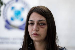 Θύμα αστυνομικής βίας η βουλευτής του ΜέΡΑ 25 Μαρία Απατζίδη