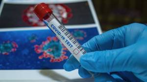 Πότε πρέπει να κάνω μοριακό test έπειτα από θετικό rapid