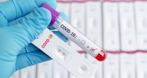 Λιναρδάκης: 4 εκατ. self tests έως τη Δευτέρα