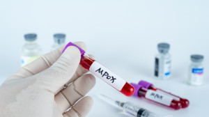 Mpox: Η ενημέρωση του ΕΟΔΥ - Αυξήθηκε το επίπεδο συναγερμού