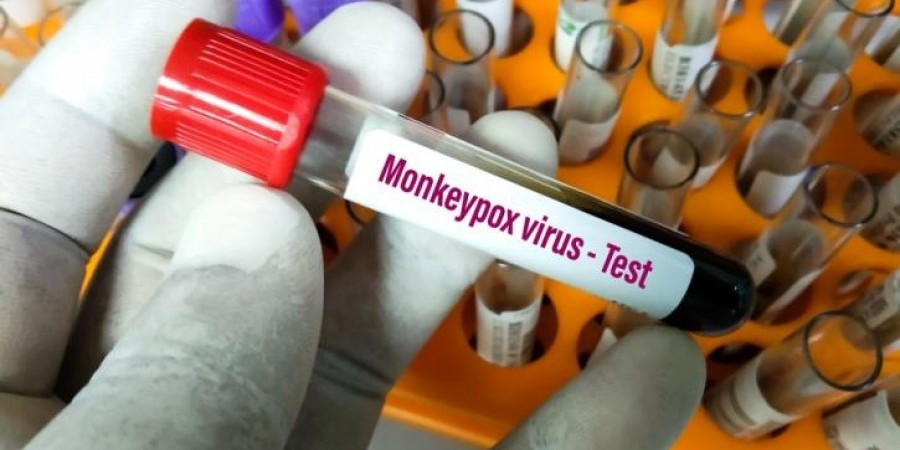 Ευλογιά των πιθήκων: Στα 54 τα κρούσματα στην Ελλάδα