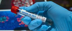 Δωρεάν rapid test: Πού γίνονται σε ολόκληρη την Ελλάδα