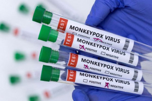 Ευλογιά των πίθηκων: Αύξηση των κρουσμάτων κατά 20% παγκοσμίως