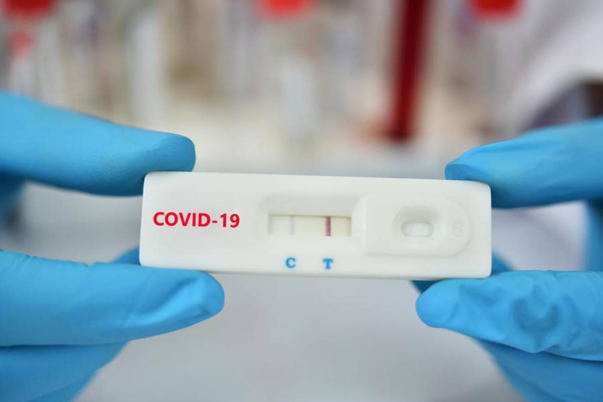 Rapid test: Διευκρινίσεις για την υποβολή υπεύθυνης δήλωσης στο ΕΡΓΑΝΗ