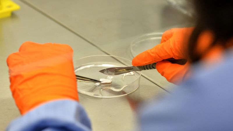 Γιατί πρέπει να επενδύσετε στις μετοχές βιοτεχνολογίας