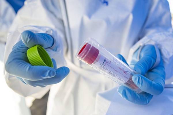 ΙΣΑ: Να συνταγογραφούνται τα PCR, όπως κάθε άλλη εξέταση