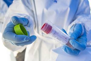 ΙΣΑ: Να συνταγογραφούνται τα PCR, όπως κάθε άλλη εξέταση