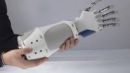 Το πρώτο mobile βιονικό χέρι με αίσθηση αφής