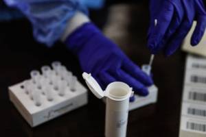 PCR: Παράνομη η επιπλέον χρέωση για γρηγορότερο αποτέλεσμα