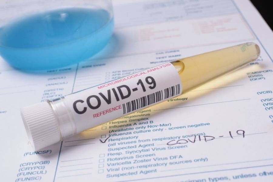 Δωρεάν rapid tests στις εγκαταστάσεις της ΔΕΘ στη Θεσσαλονίκη