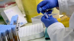 Κορονοϊός-Ελλάδα: 1.534 νέα κρούσματα- 81 θάνατοι, 571 διασωληνωμένοι