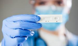 Κορονοϊός-Ελλάδα: 50 θάνατοι και 2.433 νέα κρούσματα- 556 διασωληνωμένοι
