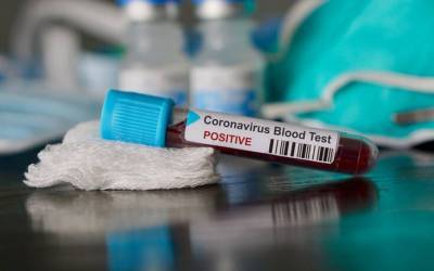 «Καμπανάκι» Europol για φάρμακα και εμβόλια «μαϊμού» κατά του κορονοϊού