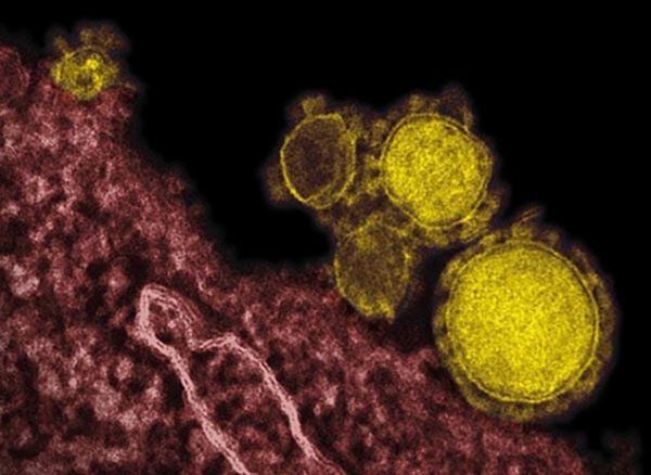 Νότιος Κορέα: Επτά οι νεκροί από τον ιό MERS