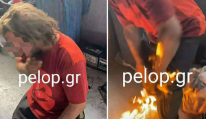 Πάτρα: Πυρπόλησαν 35χρονο Ρομά- Εντολή διερεύνησης από Θεοδωρικάκο