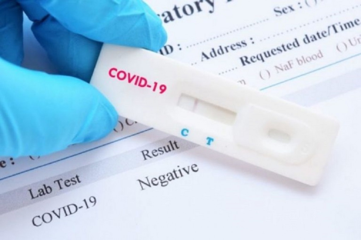 Ένα υποχρεωτικό rapid test την εβδομάδα για τους ανεμβολίαστους εργαζόμενους