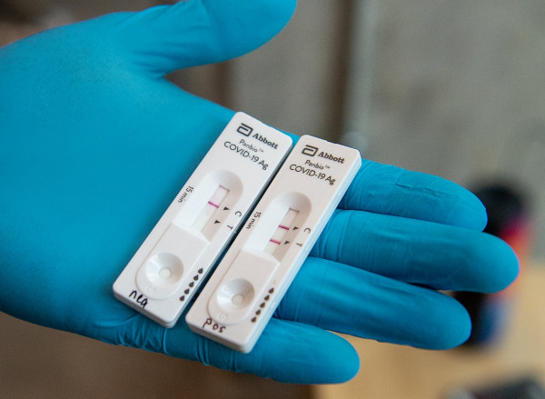 Covid-19: Στο 22,43% η θετικότητα στα rapid tests το Σάββατο
