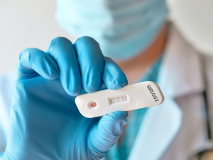 Κορονοϊός: Στο 15,57% η θετικότητα στα rapid tests του ΕΟΔΥ