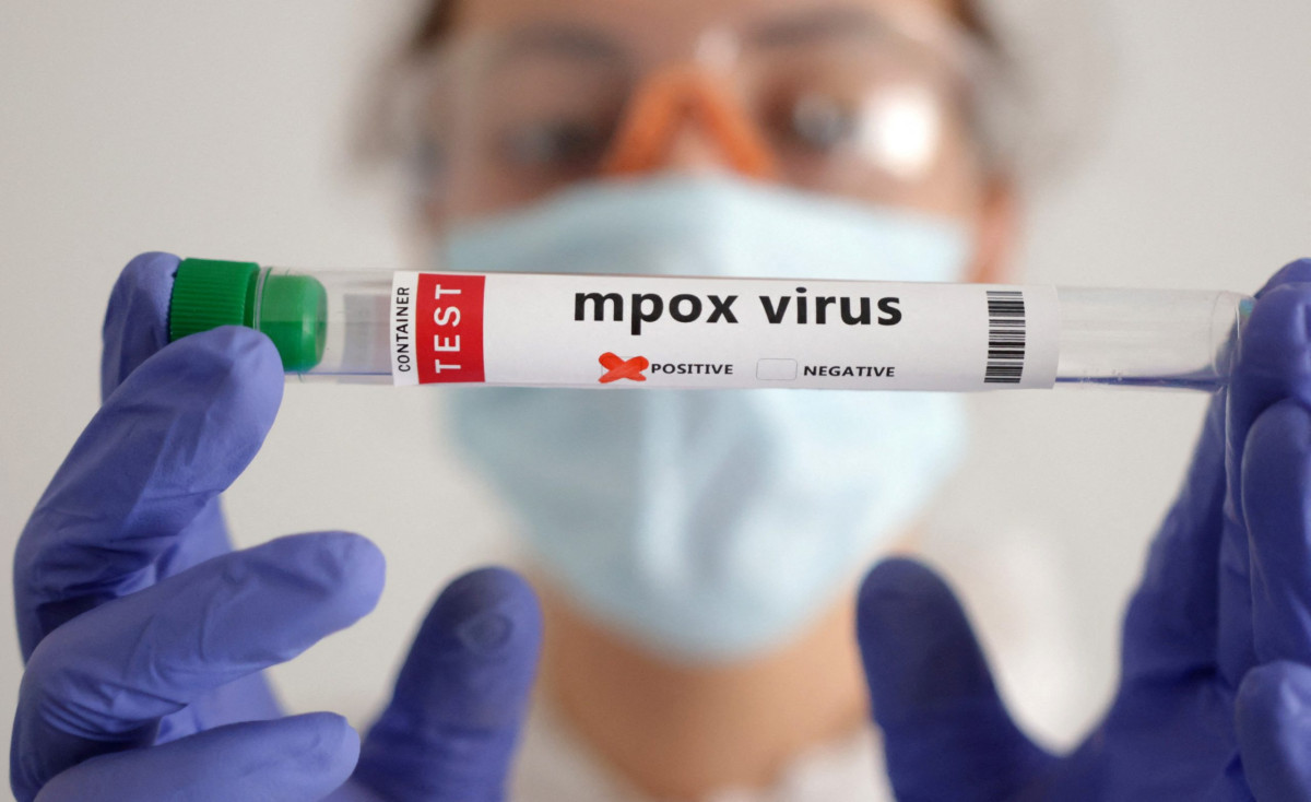 ΠΟΥ: Ανακαλεί τον συναγερμό για την ευλογιά των πιθήκων (Mpox)