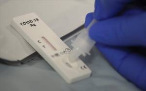 Προβληματισμένοι οι φαρμακοποιοί για τα self tests–Εξηγήσεις για τα €15