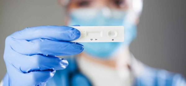 Κορονοϊός: Πού γίνονται δωρεάν rapid test την Παρασκευή (10/12)