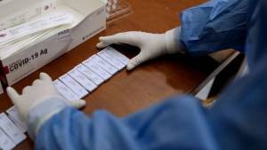 Εργάνη: Έως 15/4 οι υπεύθυνες δηλώσεις εργοδοτών για rapid test