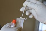 Τα self tests ως «εργαλείο» για άνοιγμα εστίασης και τουρισμού