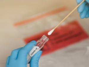 Rapid test: Κοινό πλαίσιο στην ΕΕ για την αμοιβαία αναγνώριση των αποτελεσμάτων