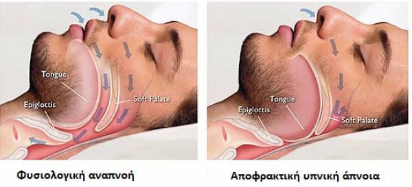 Ο σύντομος ύπνος οδηγεί σε σύντομη ζωή- Ερωτηματολόγιο STOP BANG