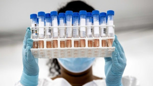 Αυξάνονται τα κρούσματα γρίπης-137 θάνατοι από κορονοϊό την εβδομάδα 19-25/12
