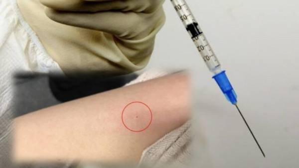 Γαλλία: Επιθέσεις με σύριγγες σε συναυλίες και νυχτερινά κέντρα
