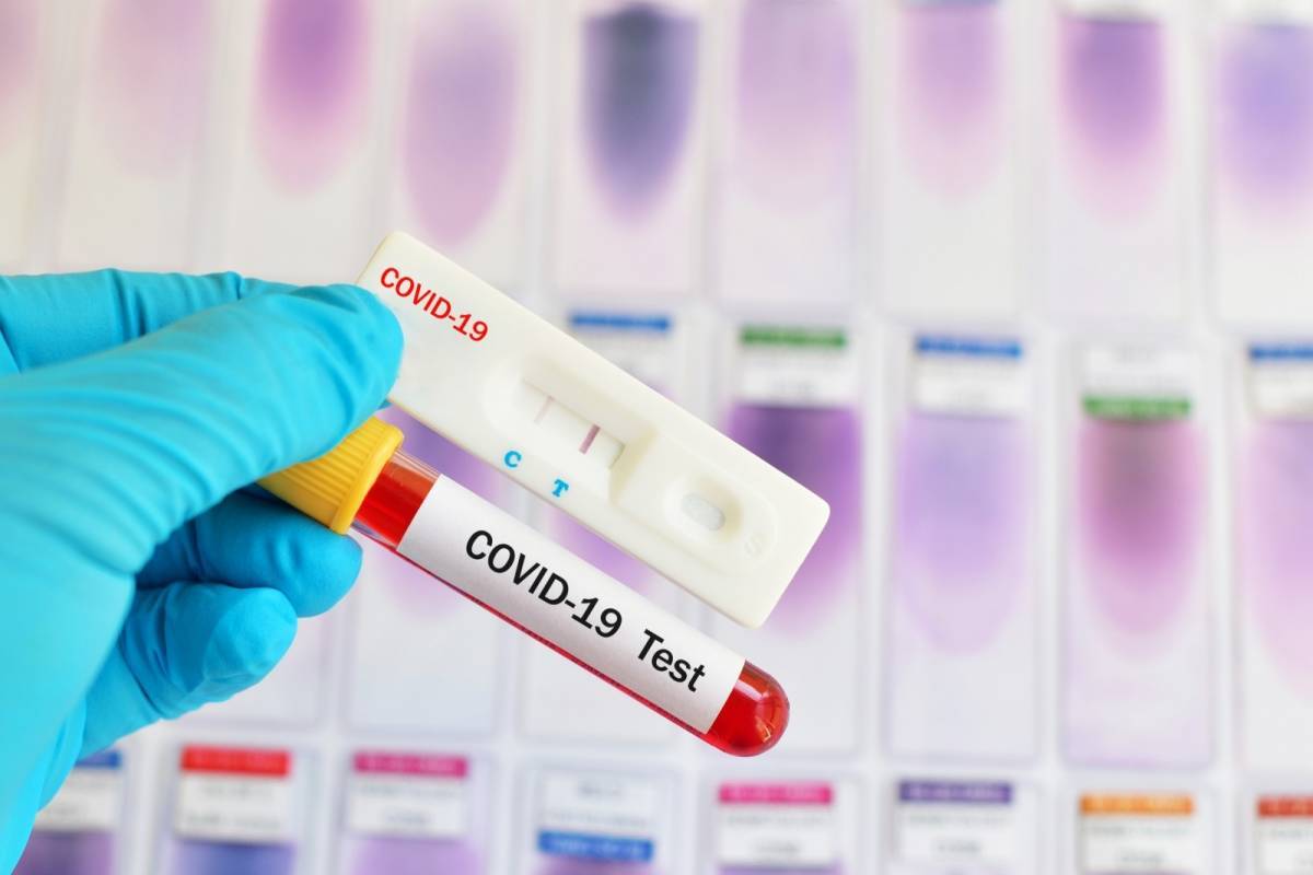 Συνολικά 1.600 rapid tests στην πλατεία Κυψέλης-Τα 28 θετικά