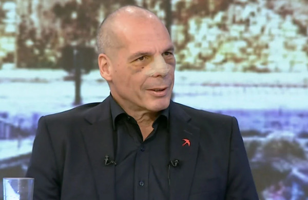 Βαρουφάκης: Τι είπε στην πρώτη τηλεοπτική εμφάνιση μετά την επίθεση