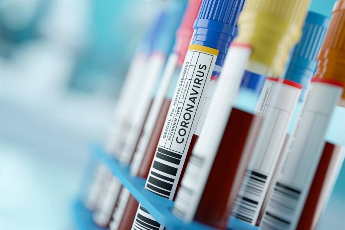 Κορονοϊός: Πάνω από 400.000 κρούσματα παγκοσμίως-Η Ευρώπη στο επίκεντρο