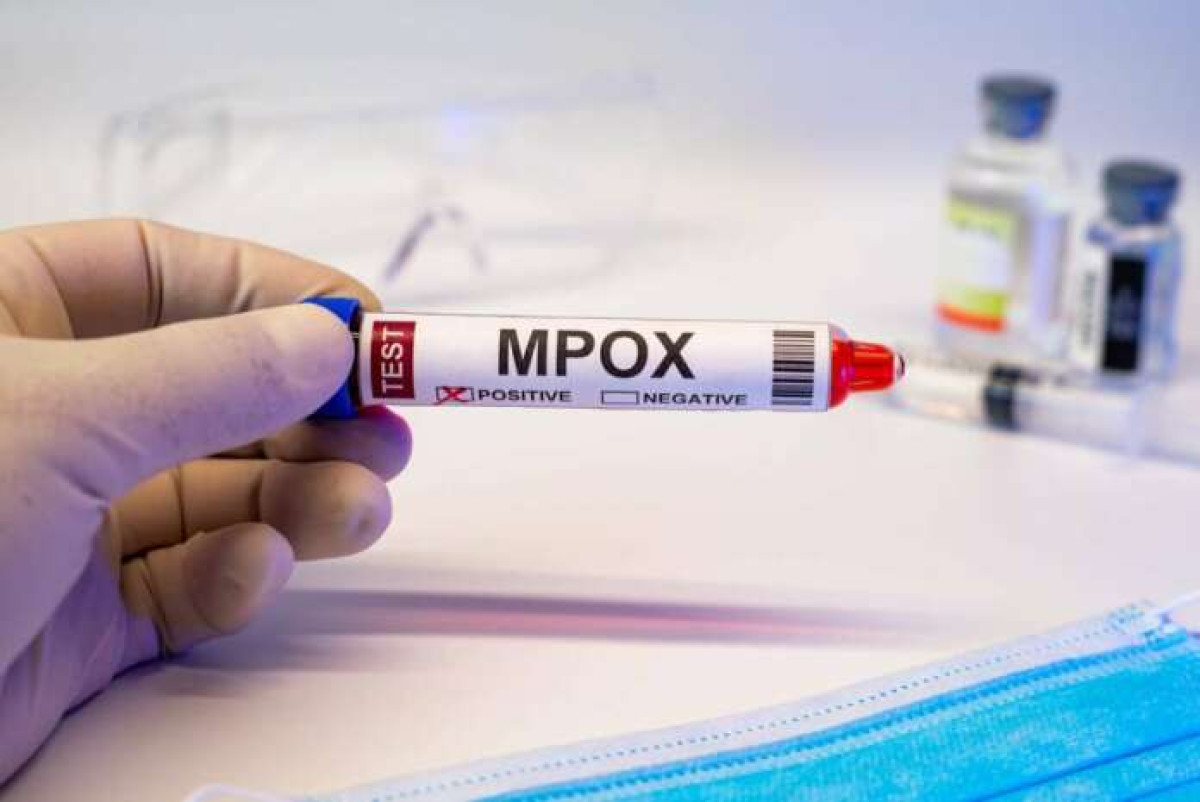 Καθησυχάζει ο ΠΟΥ: Η mpox δεν είναι η νέα covid