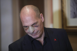 Επίθεση στον Βαρουφάκη: Ελεύθερος με περιοριστικούς όρους ο 19χρονος