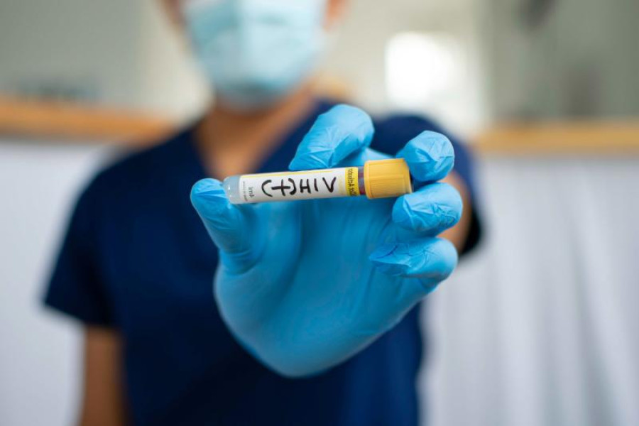 AIDS: Γονιδιακή θεραπεία «κόβει» τον HIV από τα κύτταρα